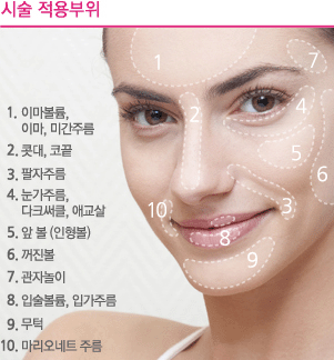 레스틸렌 적용부위